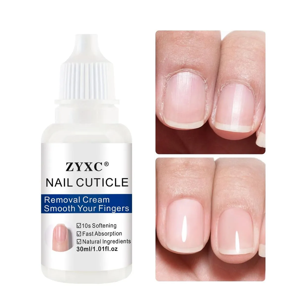 ZYXC Nail Cuticle Removal Cream 30ml