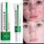 Krem nawilżający przeciwtrądzikowy Clear Face