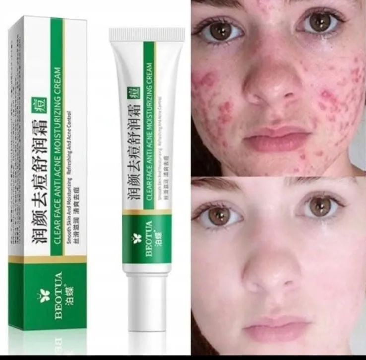 Krem nawilżający przeciwtrądzikowy Clear Face