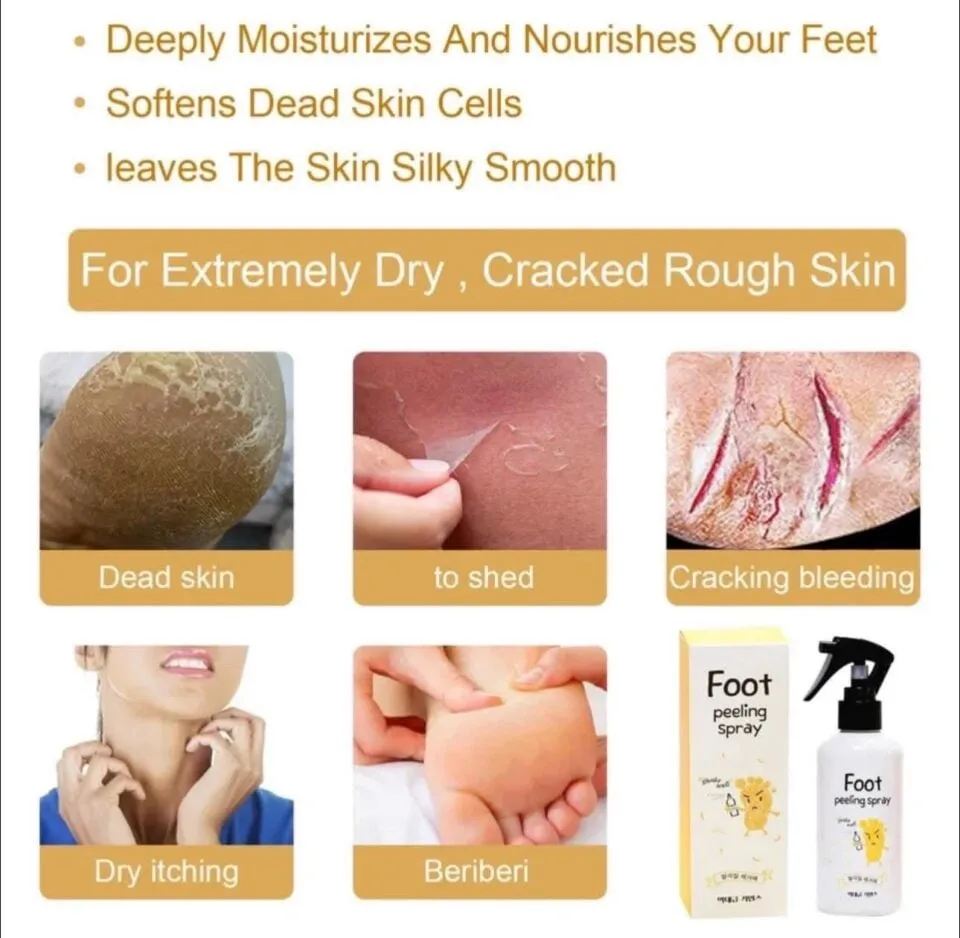 Peeling do stóp w sprayu 100ml - na zrogowacenia i suchą skórę