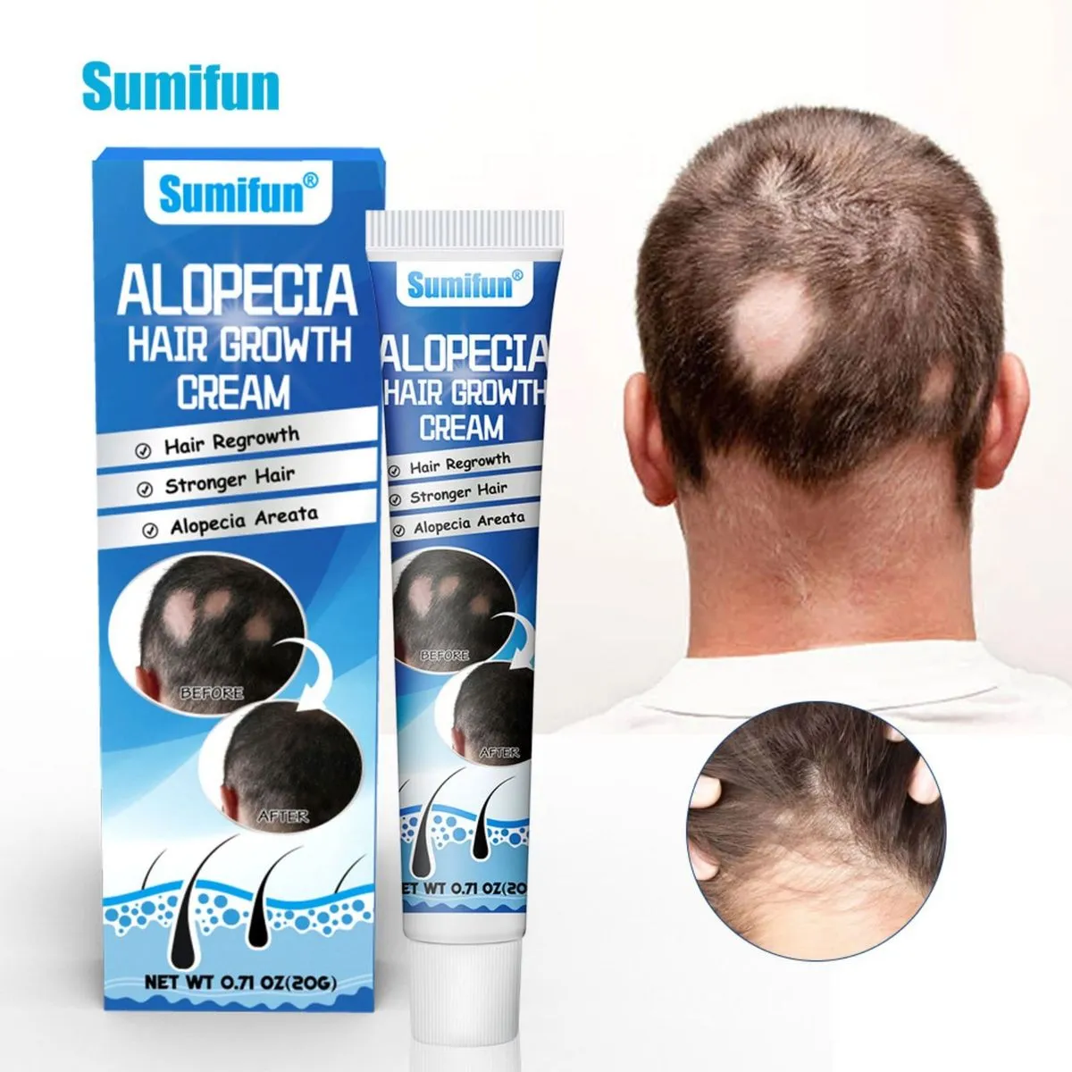 Krem Sumifun na porost włosów Alopecia 30ml