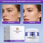 Krem TOEO 377+577 Rozjaśniający 50g Usuwanie Przebarwień